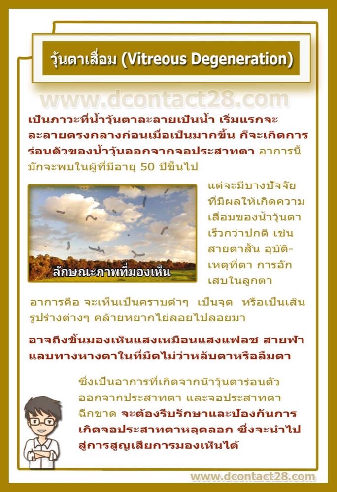 วุ้นตาเสื่อม